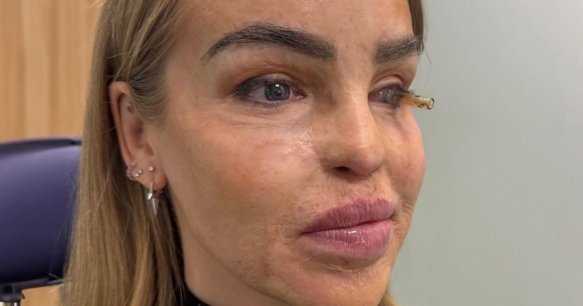 Katie Piper shares emotional health update after 'years of battling with eye' – The Mirror