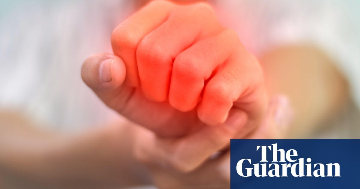 Autoimmune disease may almost double risk of mental ill health, study suggests – The Guardian Autoimmune disease may almost double risk of mental ill health, study suggests – The Guardian